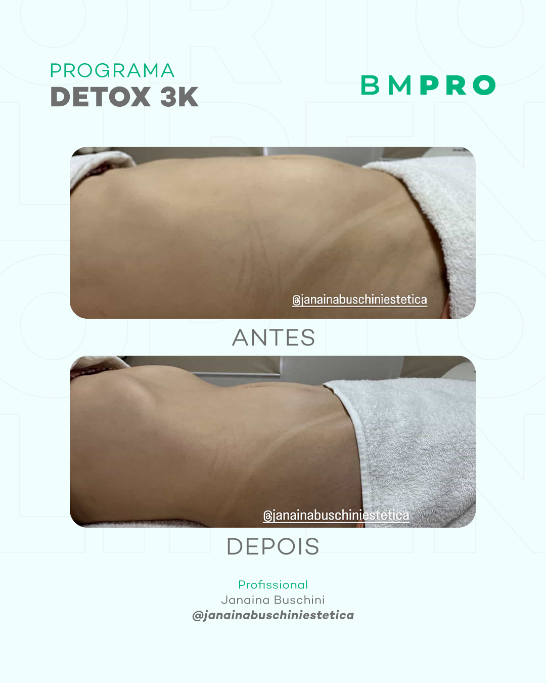 Antes e depois — detox e emagrecimento por profissional habilitada