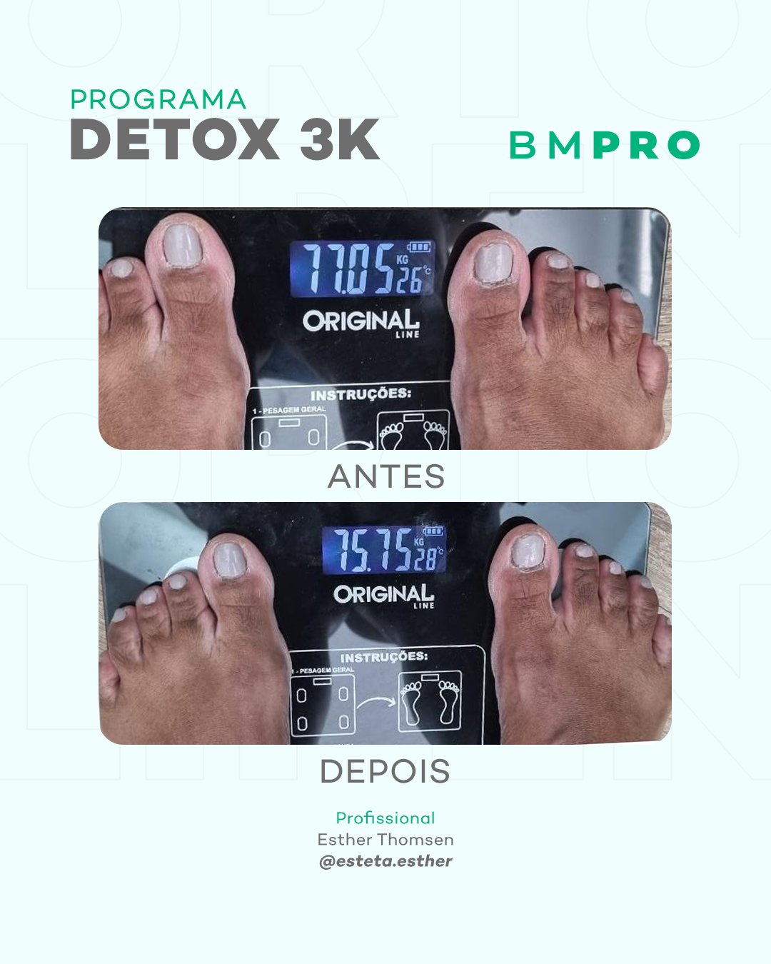 Antes e depois — detox e emagrecimento por profissional habilitada