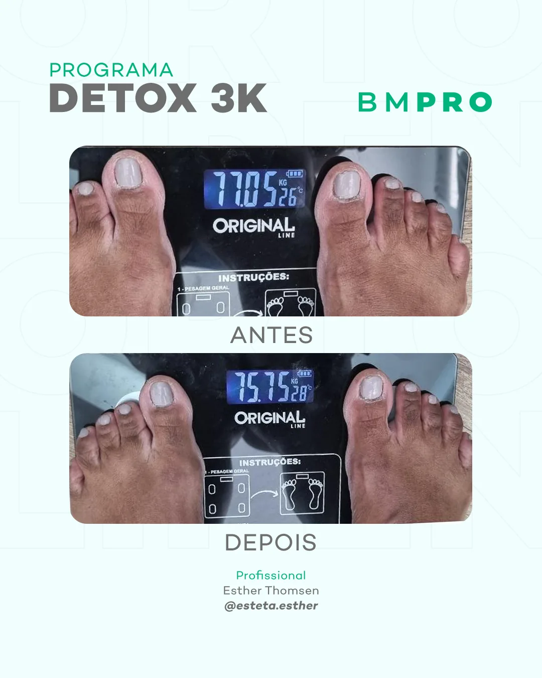 Antes e depois — detox e emagrecimento por profissional habilitada