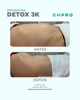 Antes e depois — emagrecimento e detox por profissional habilitada