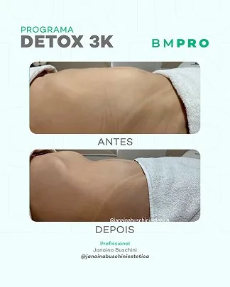 Antes e depois — emagrecimento e detox por profissional habilitada