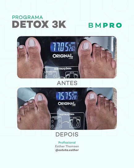 Antes e depois — emagrecimento e detox por profissional habilitada