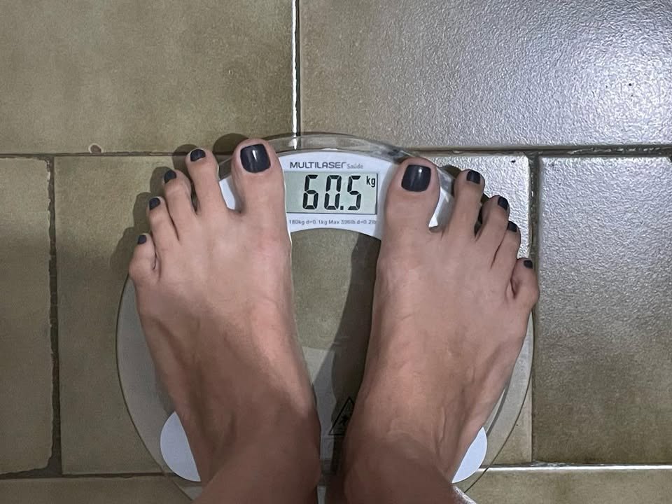 Antes e depois — emagrecimento e detox por profissional habilitada