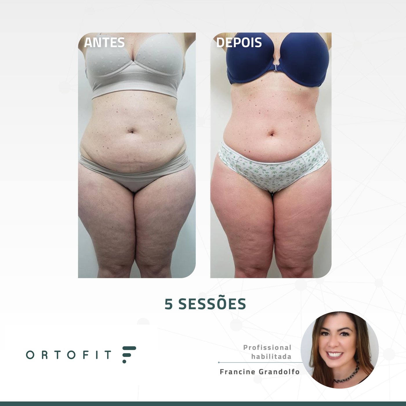 Antes e depois — emagrecimento e detox por profissional habilitada