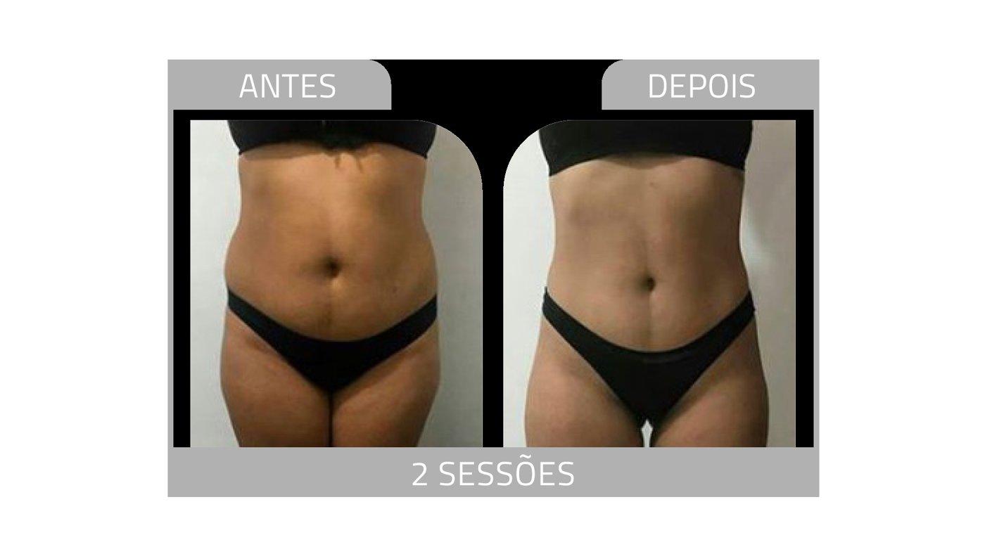 Antes e depois — emagrecimento e detox por profissional habilitada