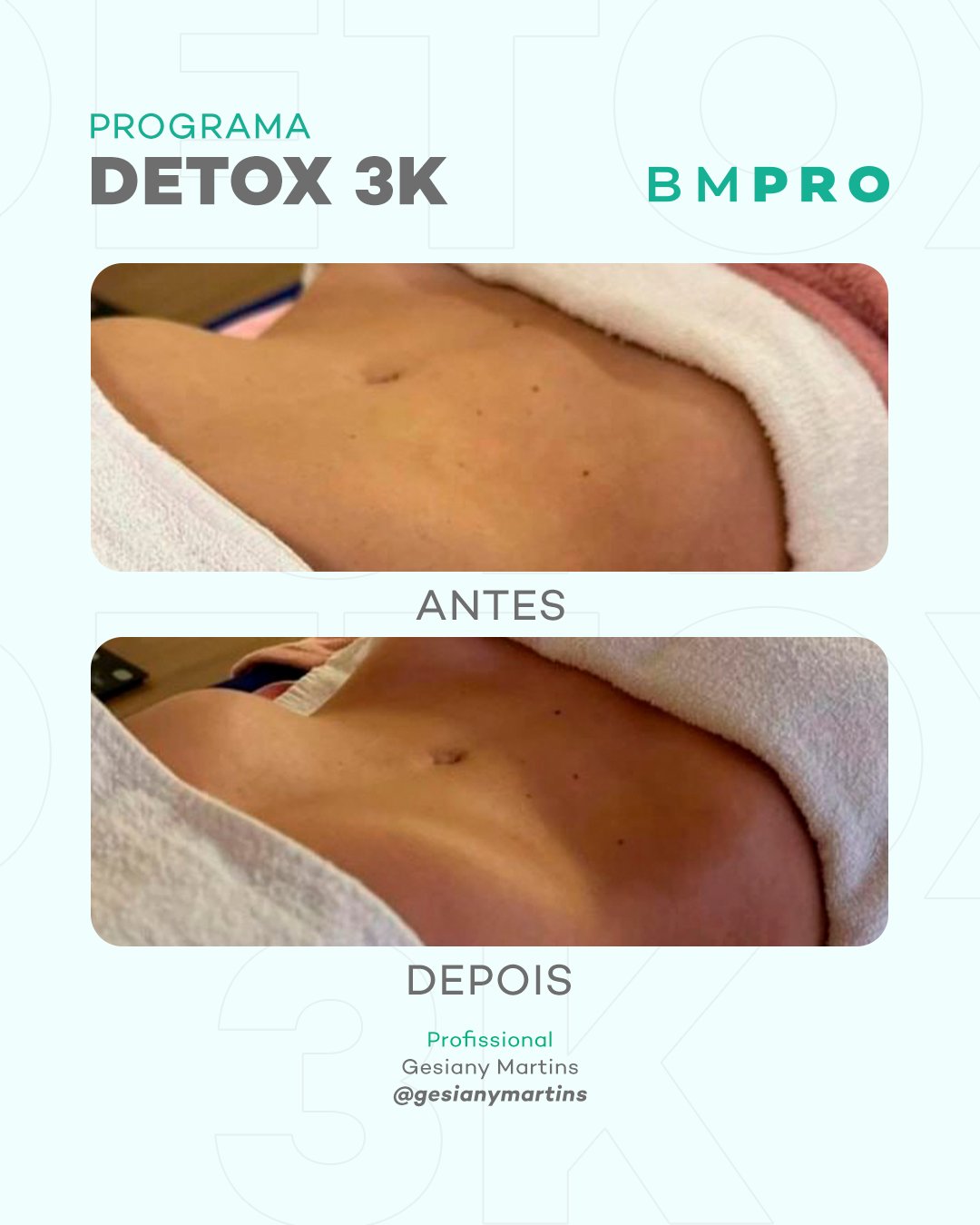 Antes e depois — emagrecimento e detox por profissional habilitada